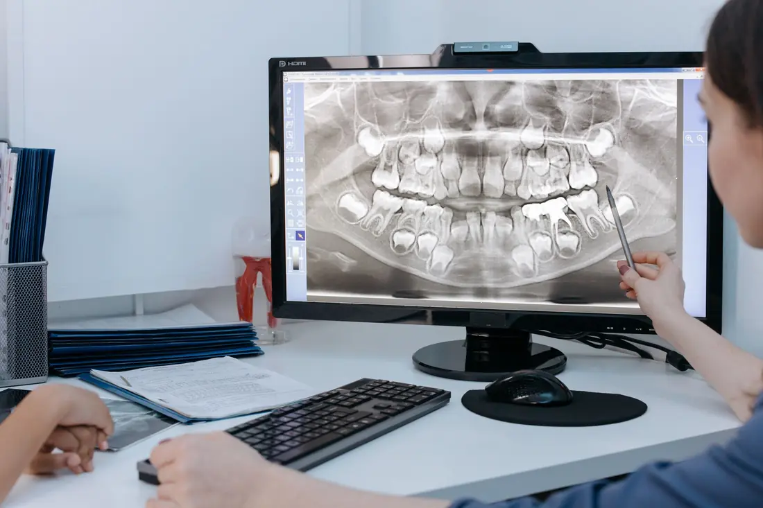 Digital X-ray