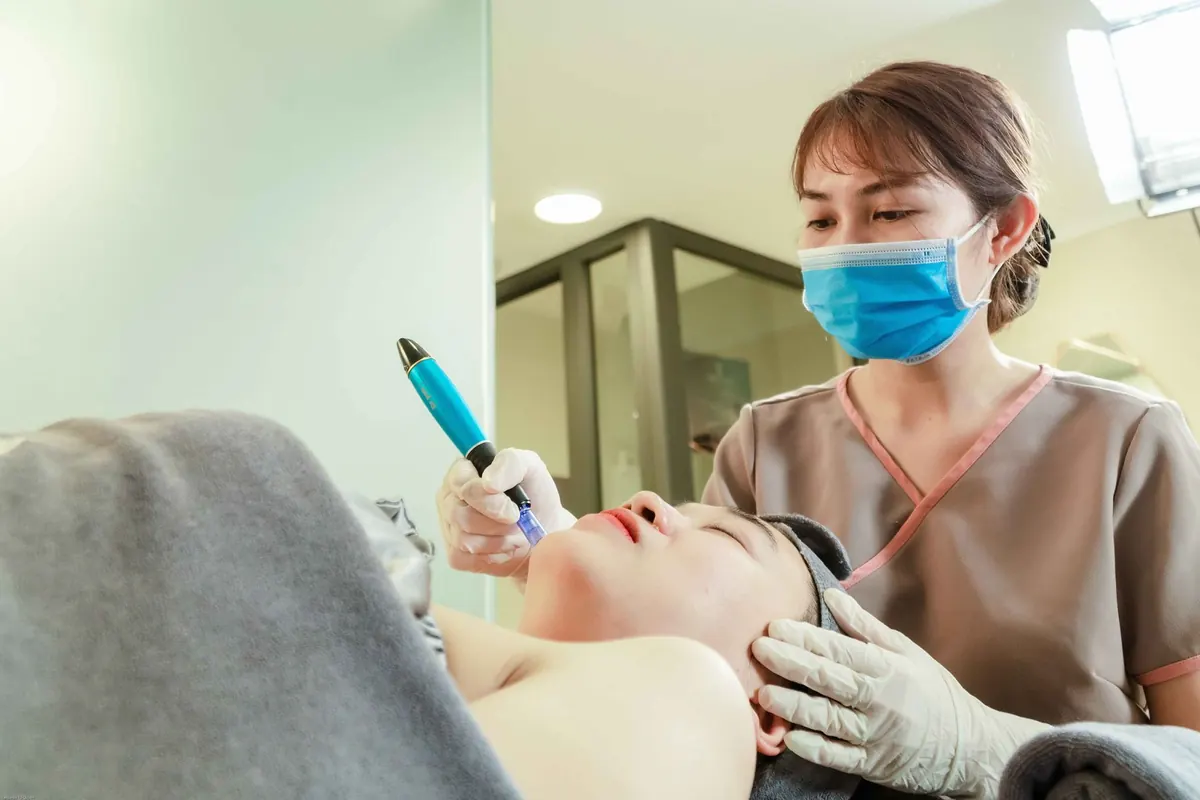 Microneedling